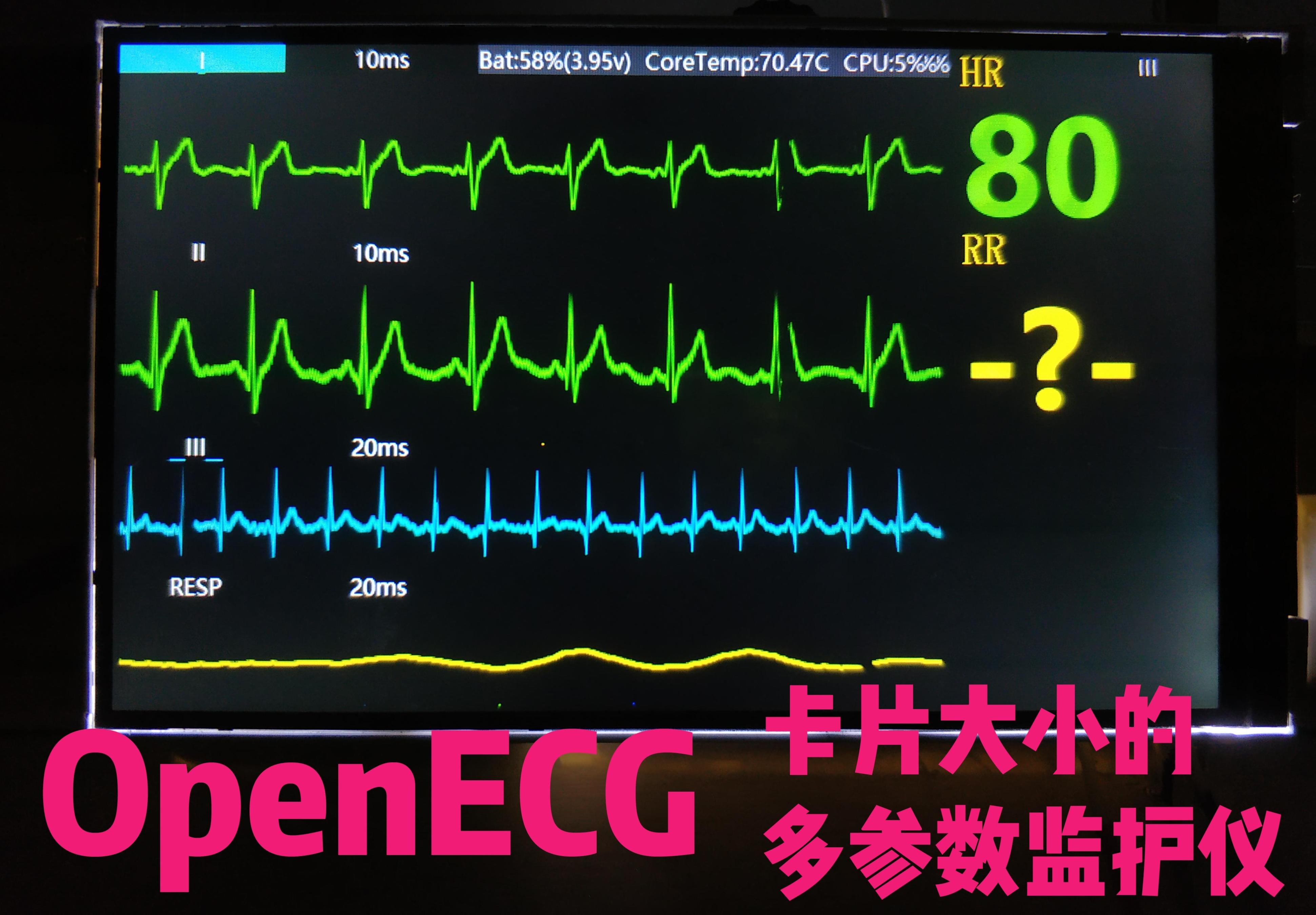 这三名学生，荣获第七届立创电子设计开源大赛自由赛道特等奖