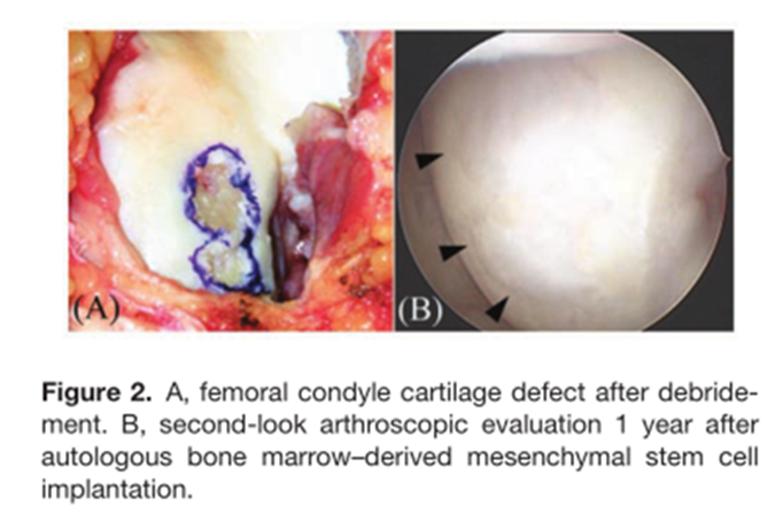 关注世界杯｜40名职业运动员使用干细胞疗法
