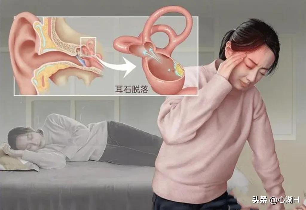 耳朵里的小石头掉了怎么办,耳朵里有小石头是怎么回事