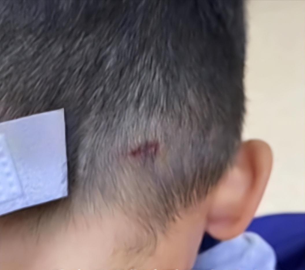 荒唐：什么时候，打伤别人的孩子竟然不是“坏孩子”了？进步了？