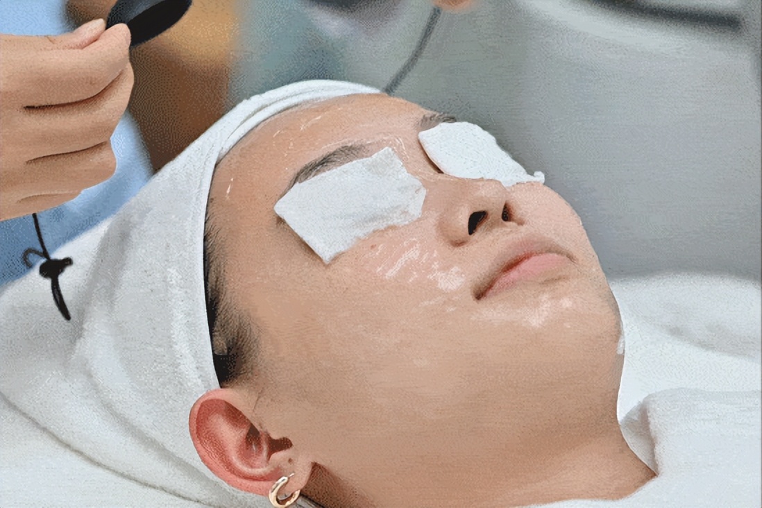 进行光子嫩肤有哪些误区,对光子嫩肤的误区