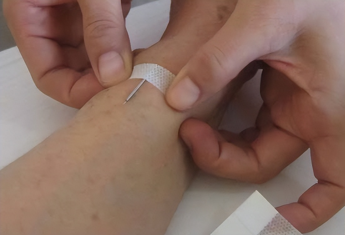 小儿喉气管炎治疗方法,中医小儿喉炎怎么治最快最有效