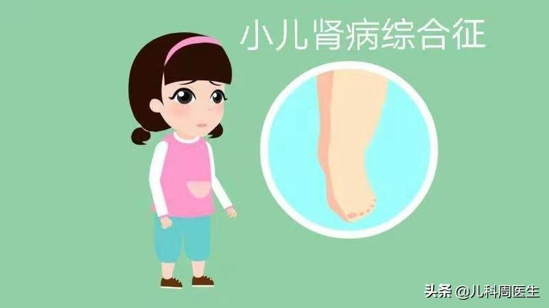 孩子睡醒眼睛浮肿眼袋也肿,小孩子睡一觉眼睛肿了已排除肾病