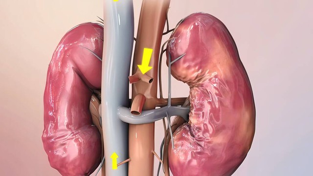 非奈利酮治疗糖尿病肾病要吃多久,不是糖尿病肾病能用非奈利酮吗