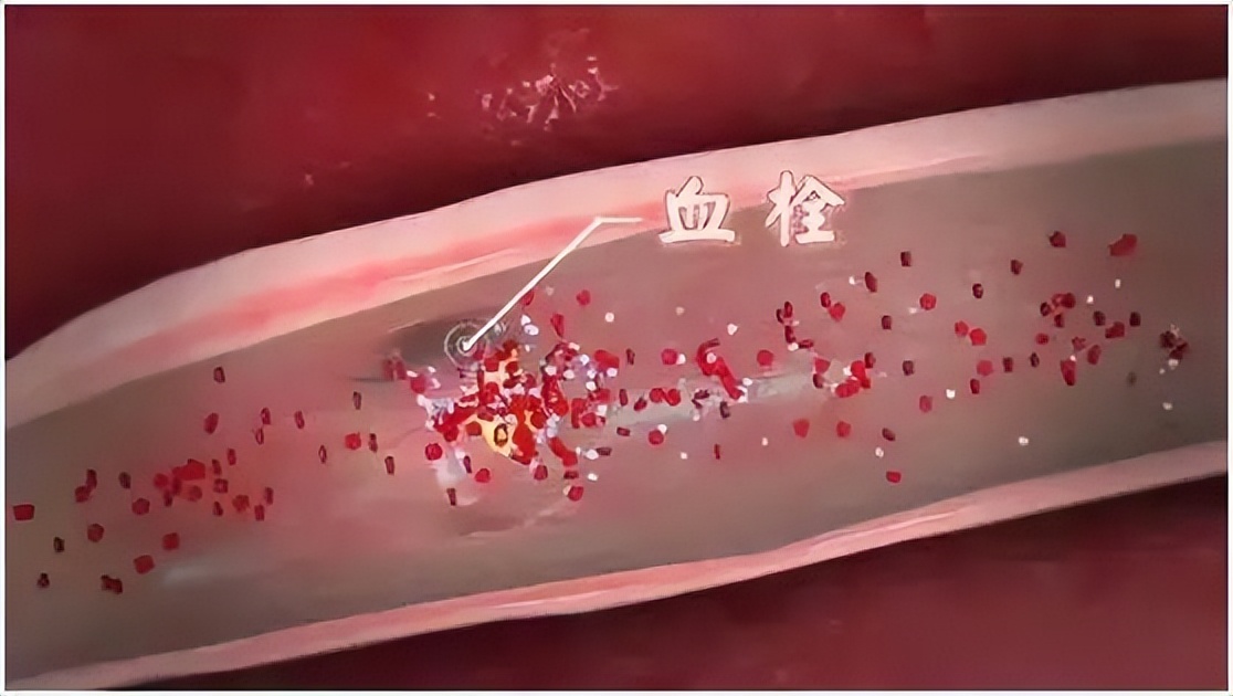 补充维生素c可以预防溃疡吗,溃疡吃维生素c可以吗