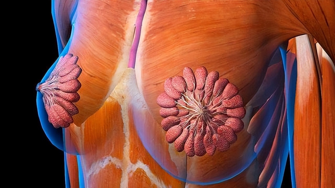 检查乳腺结节4类什么意思,乳腺结节手术是微创好还是开刀好