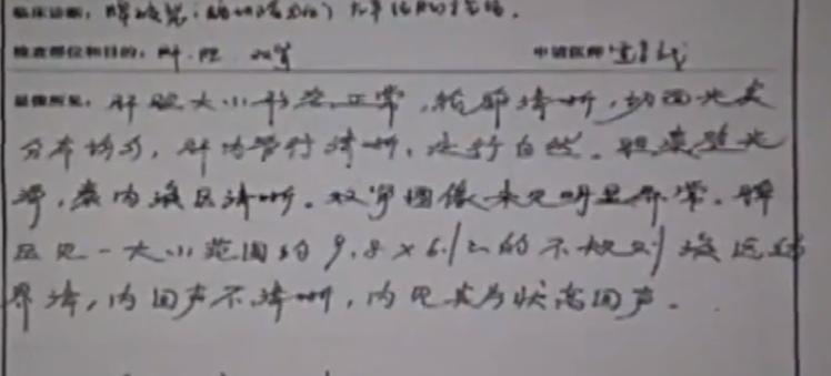 女孩单位体检时少一个肾最后结果,入职体检查出少个肾