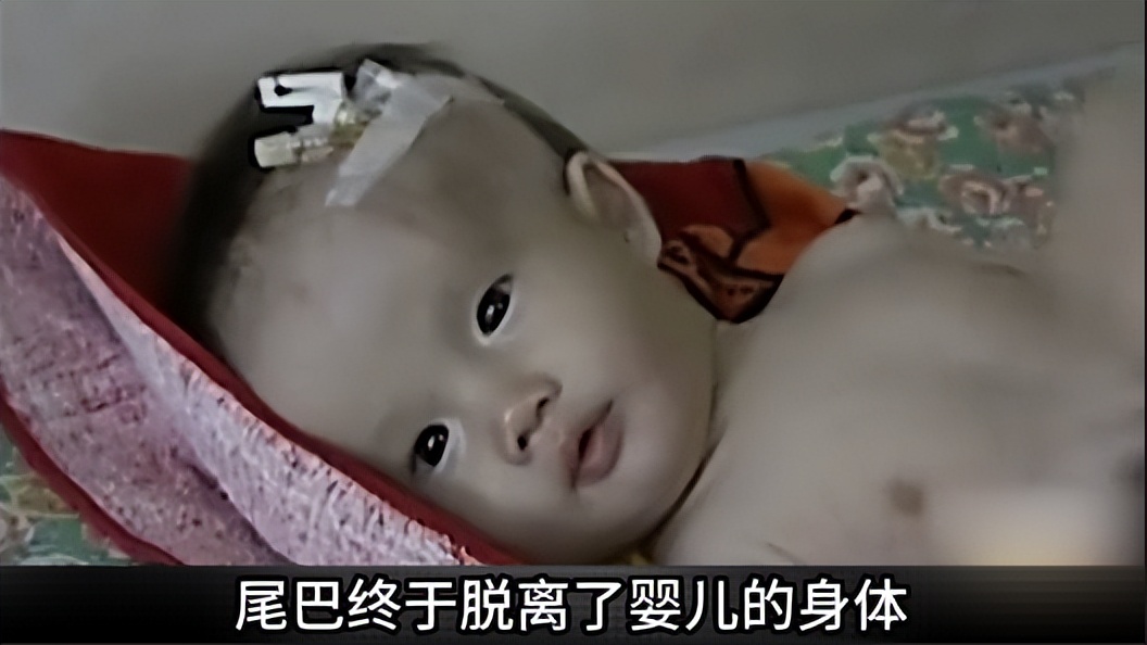 母猴子怀孕生下三胞胎,孕妇生下来的猴子