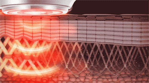 毛孔粗大收缩毛孔最有效方法,毛孔大怎么改善真的可以收缩毛孔