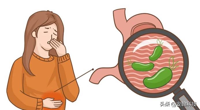 消化性溃疡为什么能做胃镜,胶囊胃镜治疗胃病