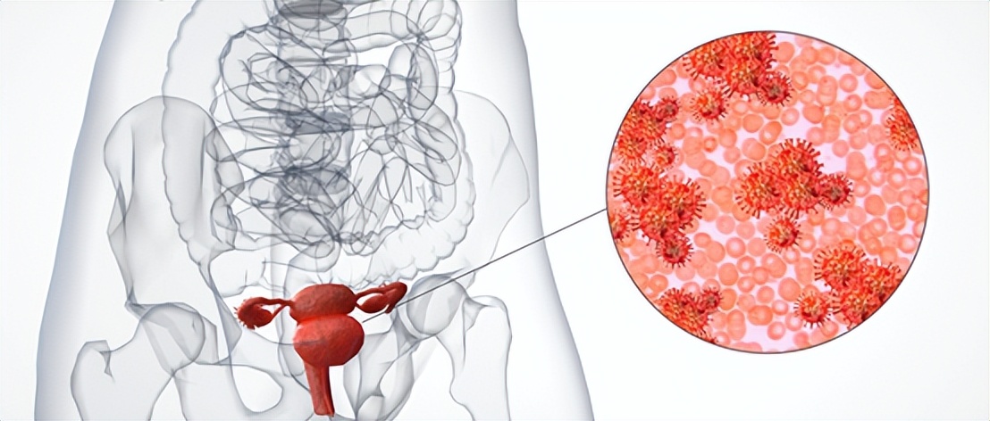 爱干净不是一件好事,爱干净就不得妇科病吗