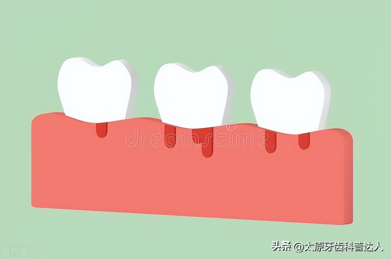 怎么预防和处理牙周炎,如何预防牙周炎最有效