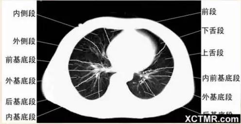 胸腹部盆腔ct主要检查什么,女性盆腔ct断层解剖结构图