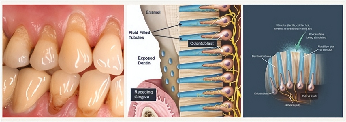usmile和飞利浦电动牙刷测评,买电动牙刷好还是冲牙器好