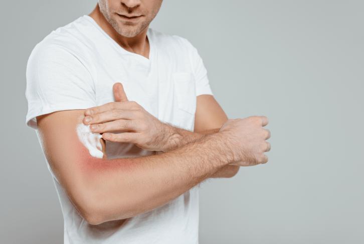 几块钱一瓶的炉甘石洗剂，虽不起眼，但可以改善这些常见病