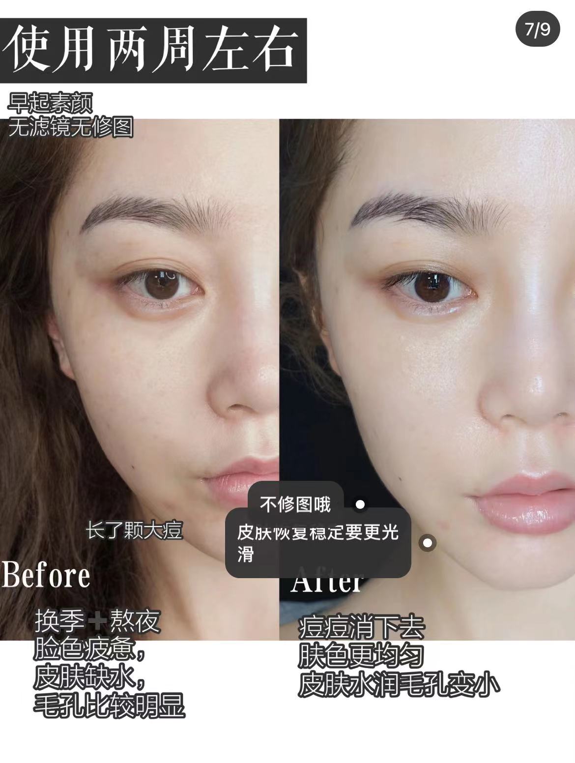 雅诗兰黛樱花版微精华露美白吗,雅诗兰黛樱花微精华露和小棕瓶