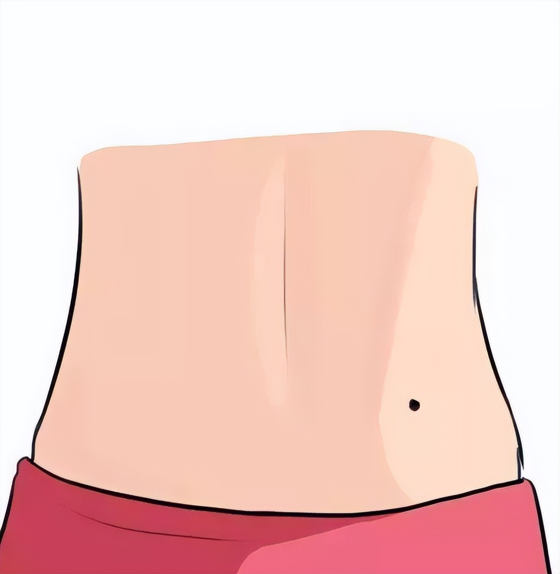 孩子身上好几处痣和妈妈的一样,小孩身上痣多有什么寓意吗