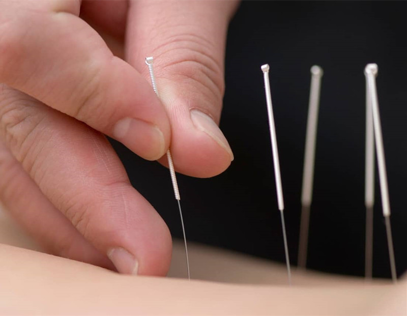 膝盖疼痛针灸要多长时间,膝盖疼痛针灸哪几个特效穴位