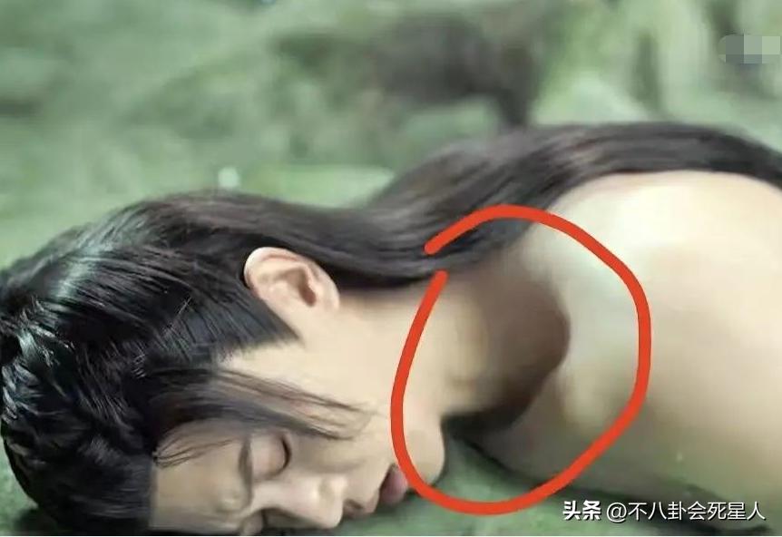 假双眼皮的明星,明星的假脸