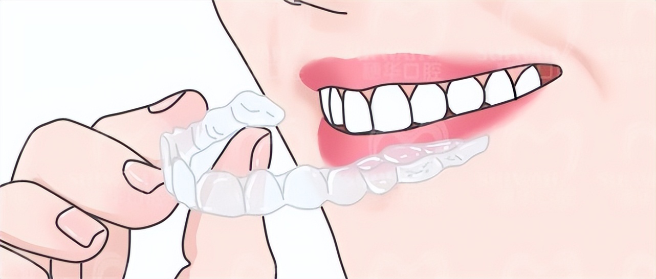 疫情期间，牙疼、牙套丢了怎么办？暨南大学穗华口腔专家在线支招