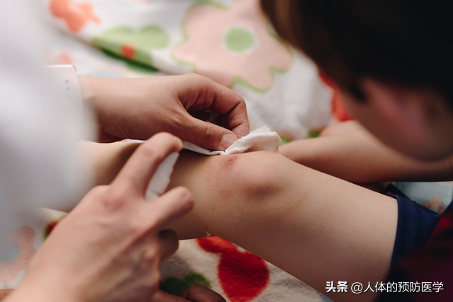 如果你被毒蛇咬的话该怎么自救,如果你在野外被咬了怎么办