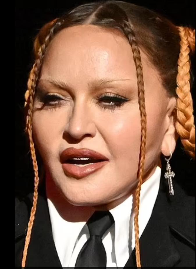 天哪!这是天后麦当娜吗?怎么变成了这个鬼样?