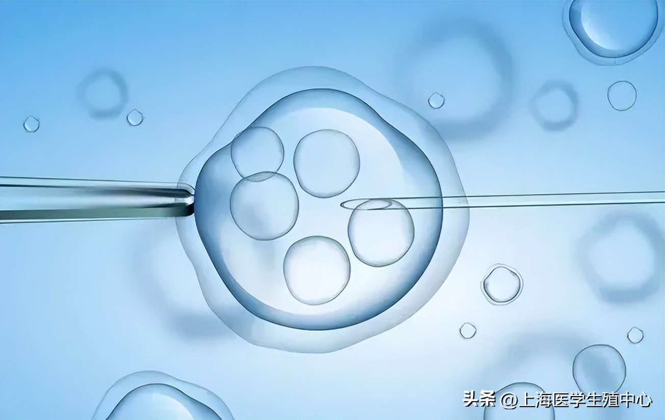 试管婴儿全过程就三个步骤,十个试管婴儿全部成功