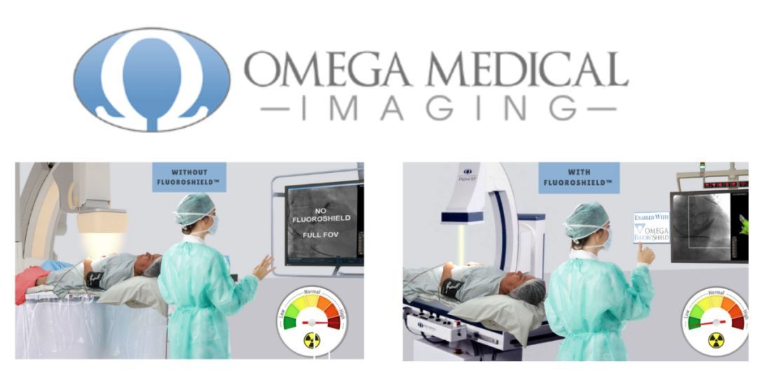 心脏射频消融机器,射频消融导管磁定位型