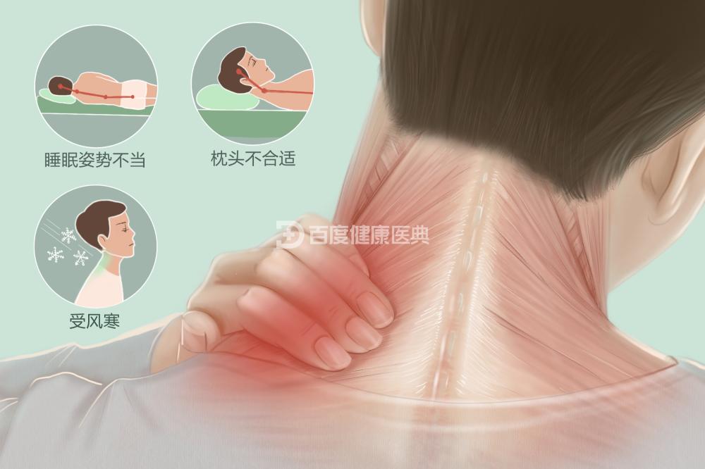 脖子一受凉就落枕这是怎么回事,脖子落枕怎样治才能好