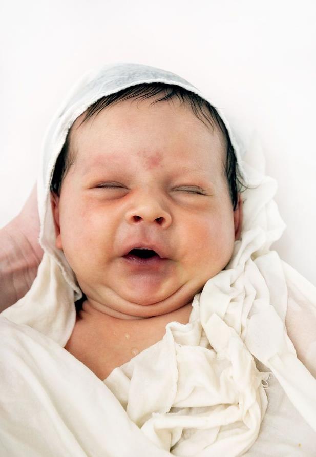 皮肤护理和皮肤保护区别,医院新生儿皮肤护理