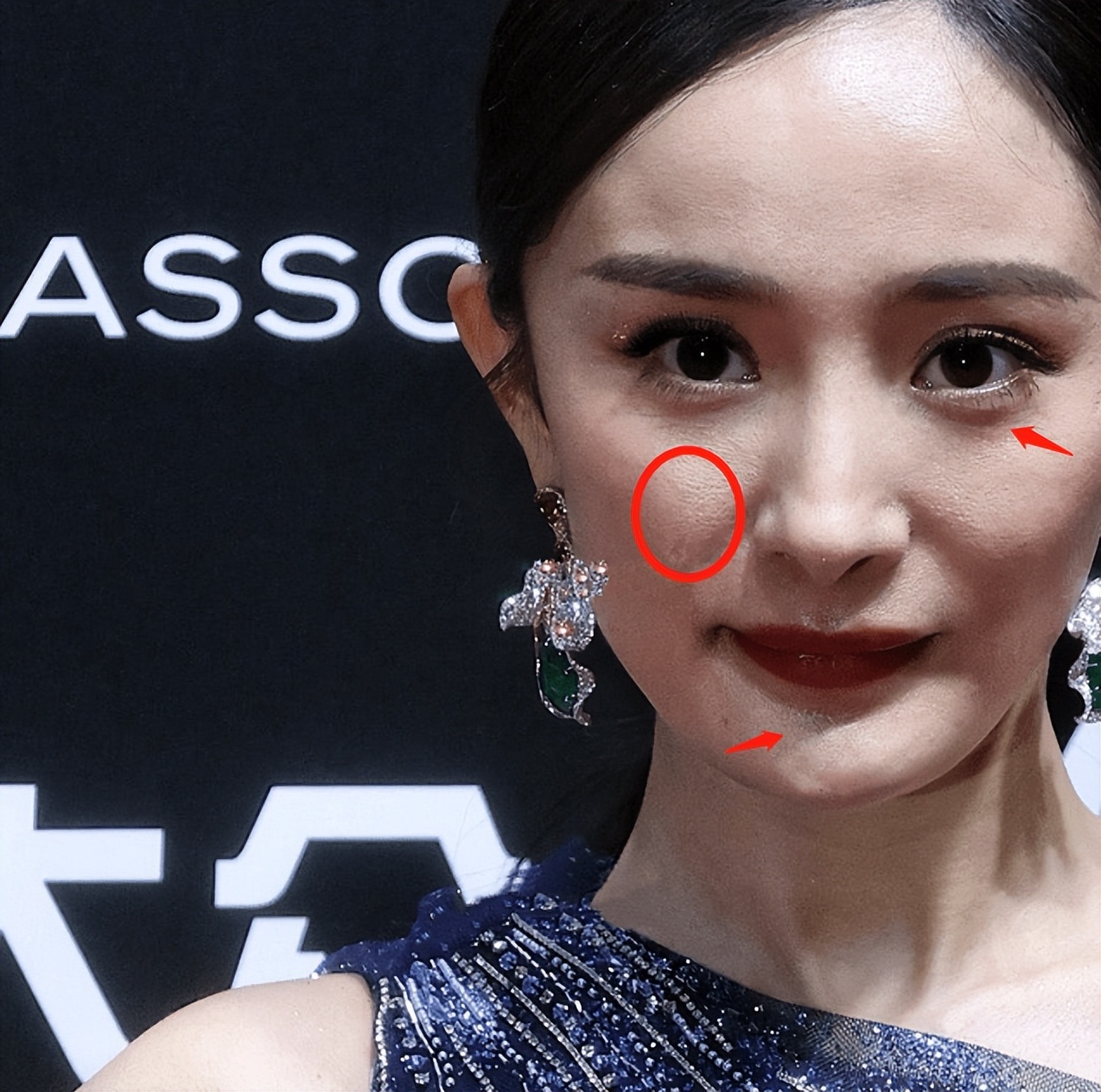 完美女神根本不存在！死皮、黑头、痘痘、毛孔…怼脸暴露真实颜值