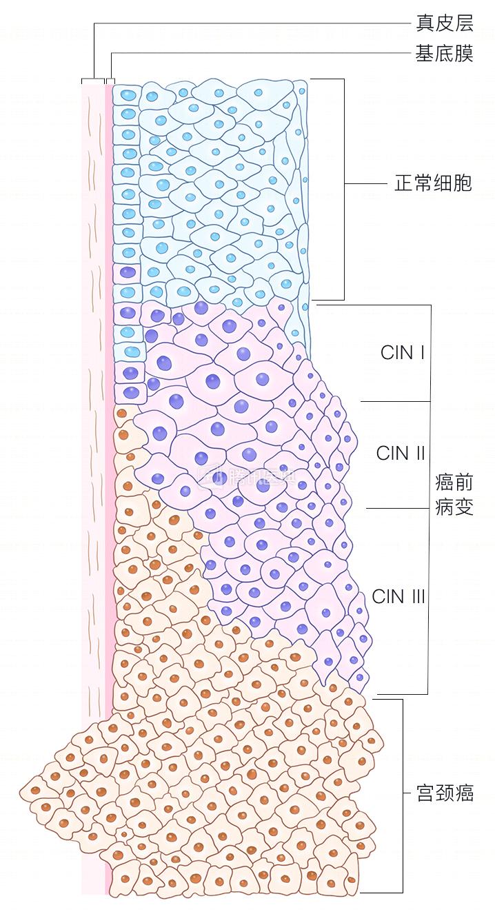 宫颈活检一般要夹几块肉出来,妇科活检需要打麻药吗