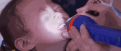 近期手足口病进入发病高峰期,打手足口病疫苗多久可以打百白破