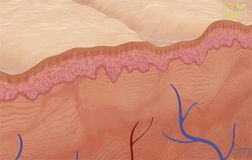 缩小毛孔最快方法小窍门,缩小毛孔的最好方法最快的