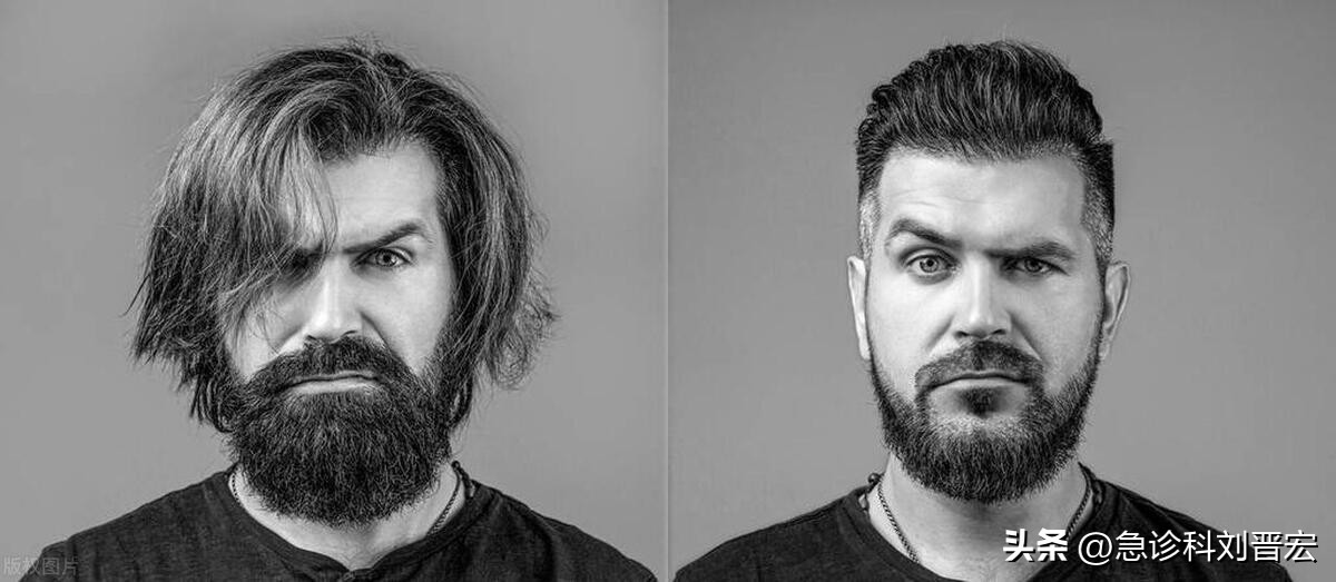 为什么中国男性不喜欢留胡子？胡须的疏密程度与性能力是否有关？