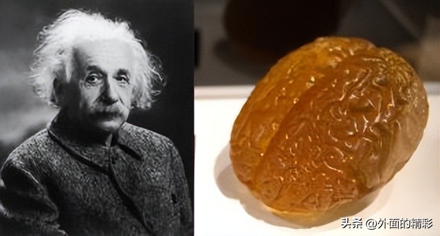 爱因斯坦去世后大脑被谁偷走,爱因斯坦去世后大脑被解剖