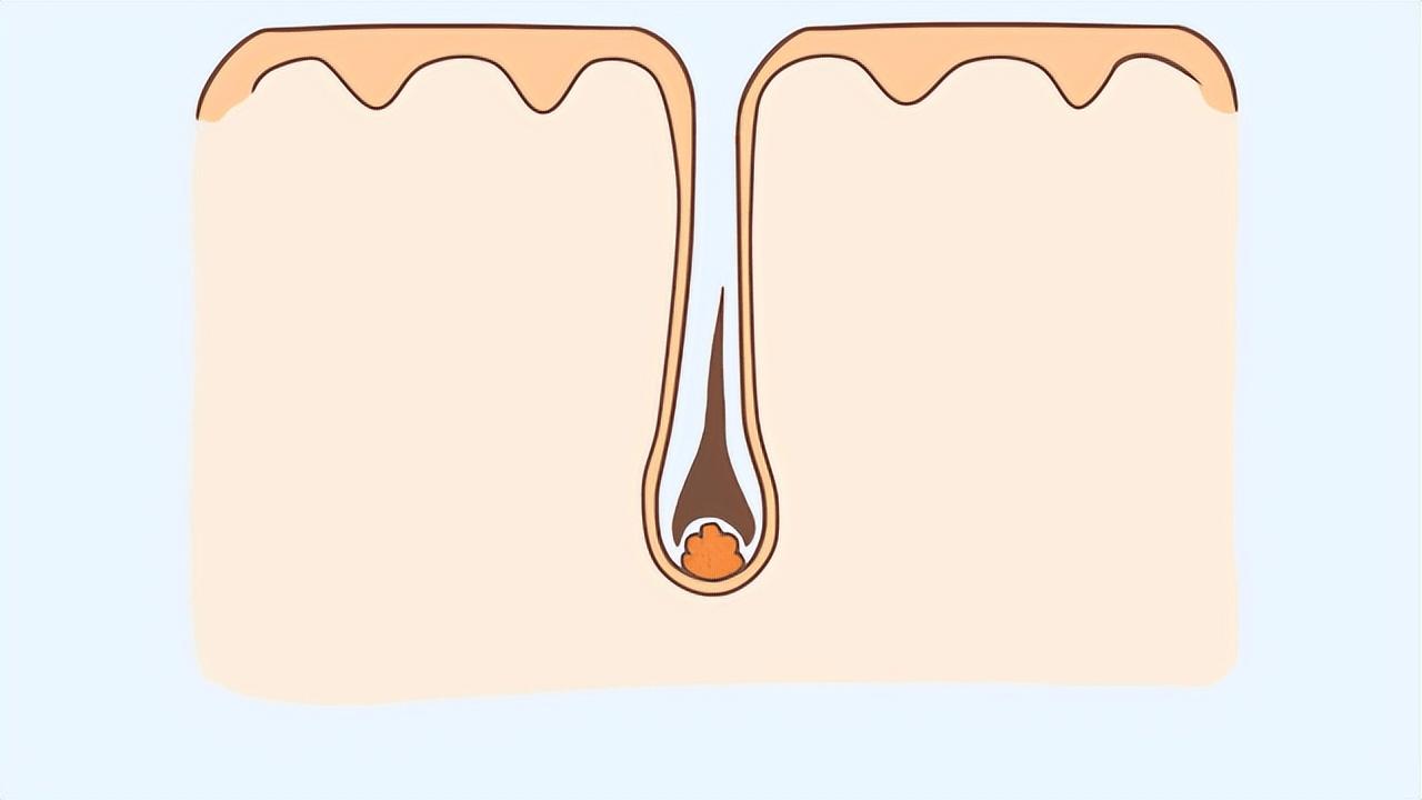 阴毛变白，就是性功能减退了？*处私**毛发的秘密，了解一下有好处