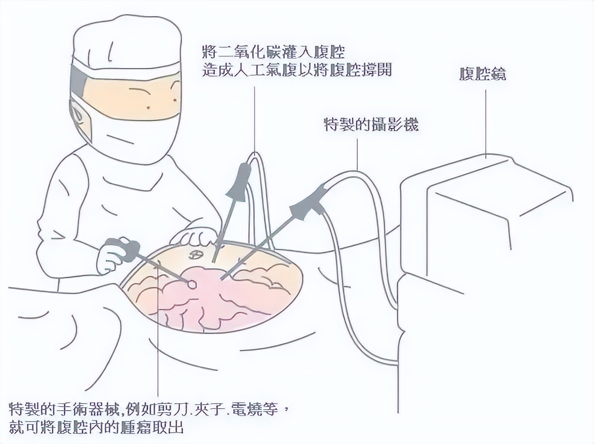 干货｜关于腹腔镜12个维护和保养的小技巧