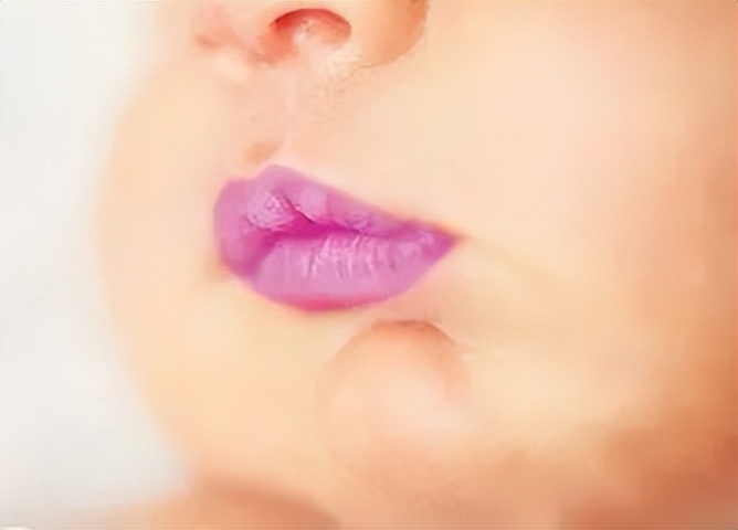宝宝嘴唇发紫是什么病的预兆,宝宝嘴唇发紫是什么原因该怎么办