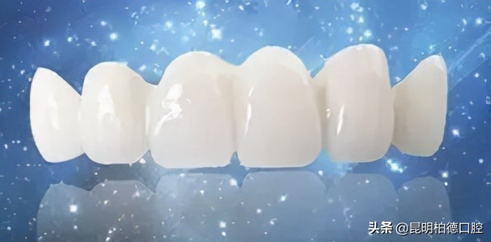 牙齿掉了一半做烤瓷牙全过程,关于牙齿烤瓷牙的一些小事情