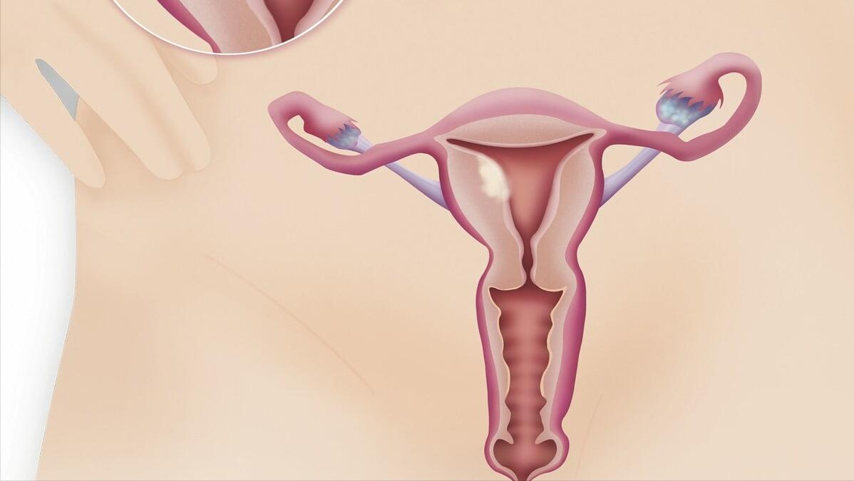 女性嘴唇边缘发痒与妇科有关吗,妇科下面特别痒什么原因