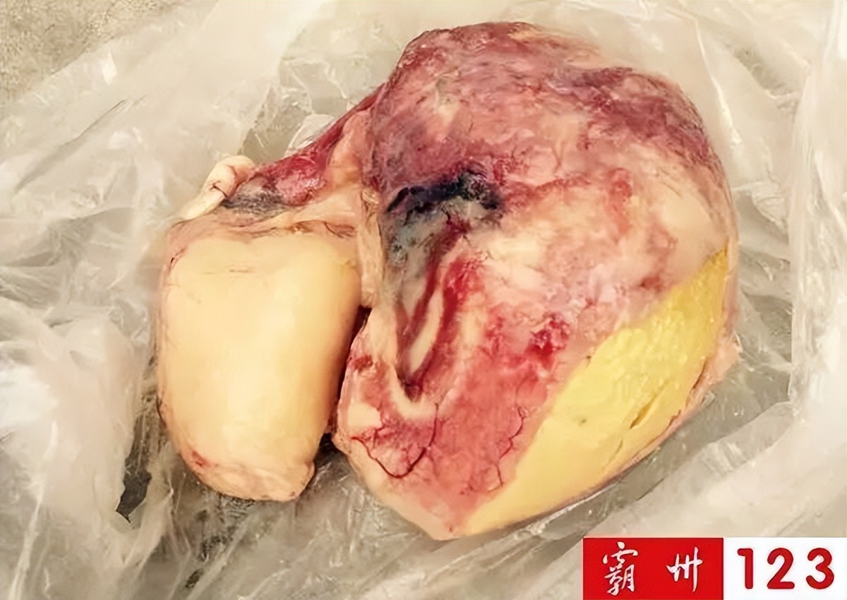 值钱？霸州村民宰鸡发现金黄色“鸡宝”？快来看看