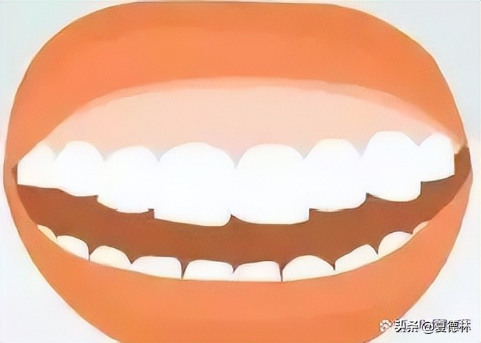 笑露牙龈怎么通过日常改善,为什么有些人笑起来露牙龈