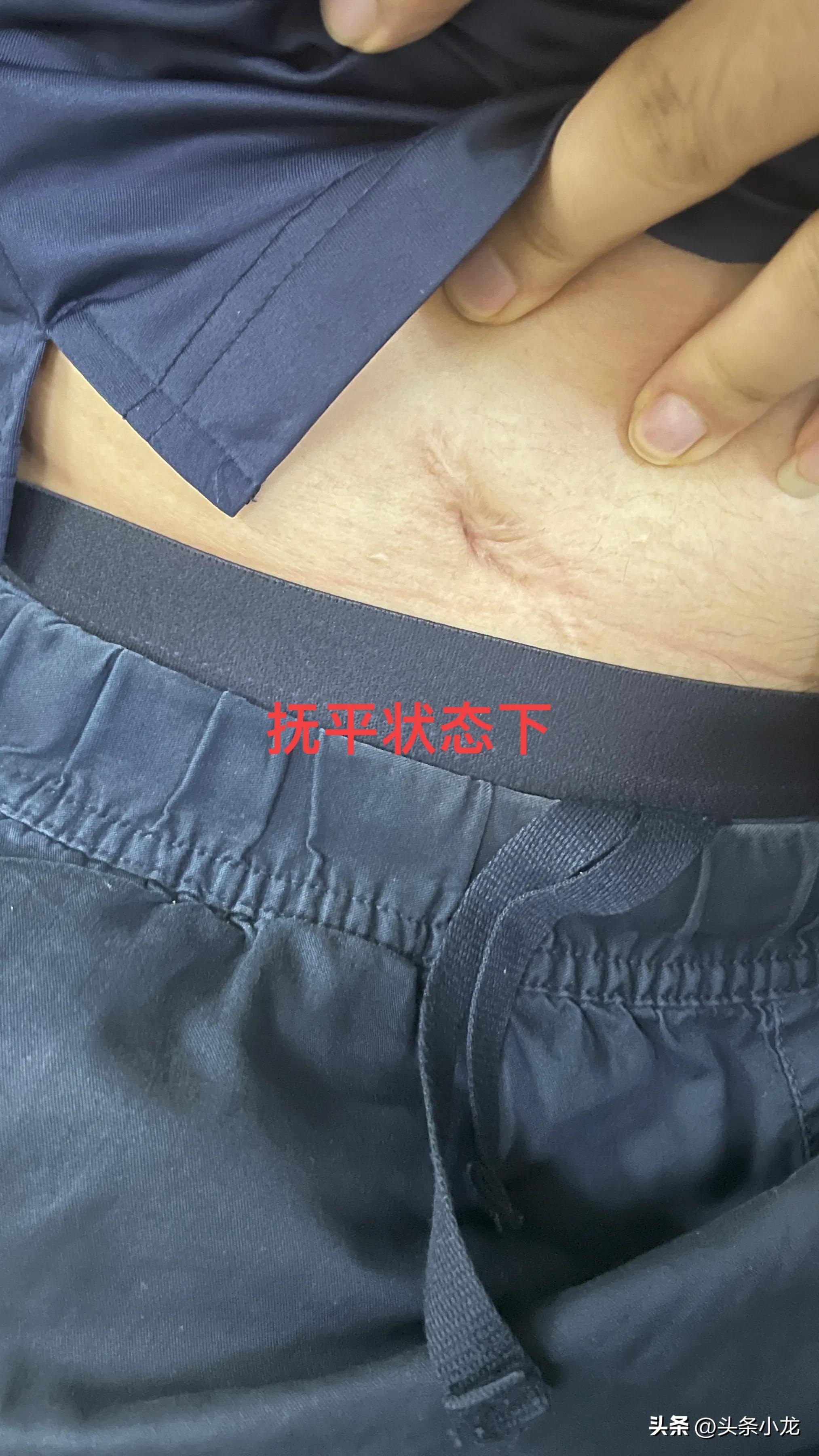 生平两次遇到比较坑的医院都是在东莞长安