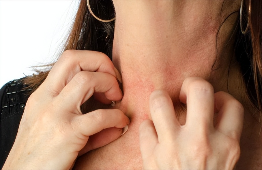 过敏洗澡能用沐浴露吗,为什么有人一洗澡就过敏