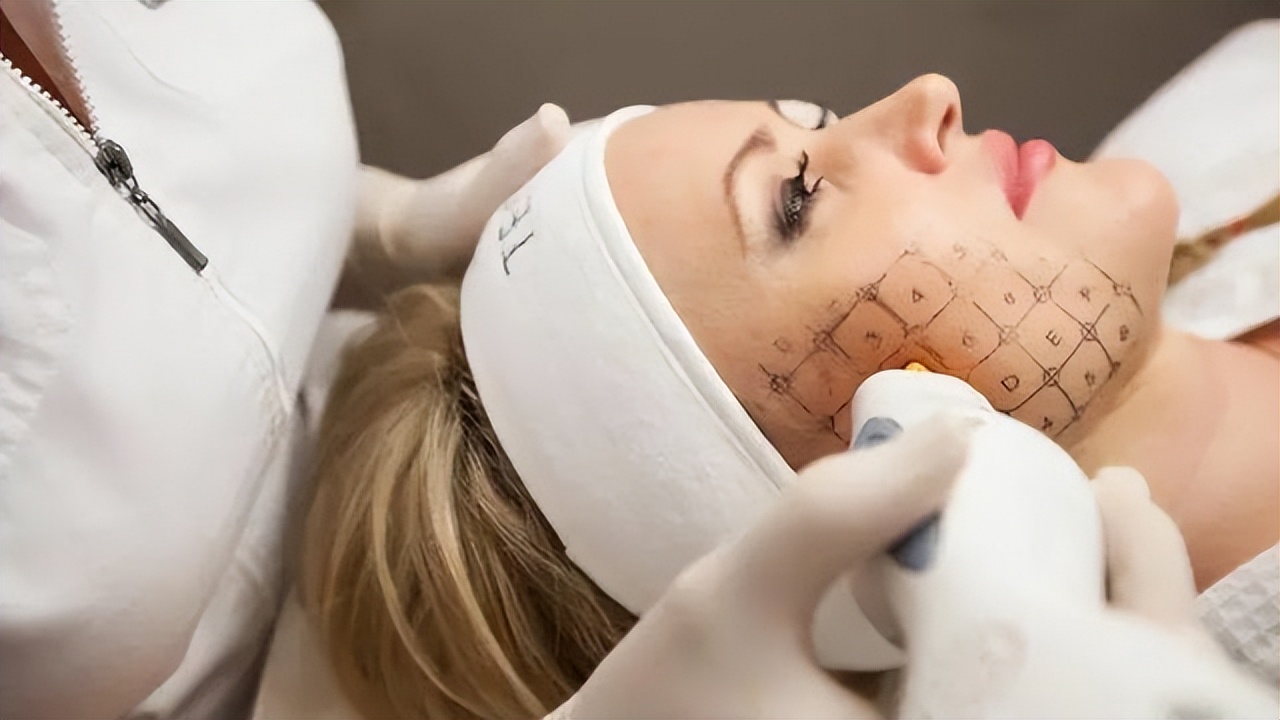 面部衰老的这五种表现你有吗,面部衰老的5个信号你出现了吗