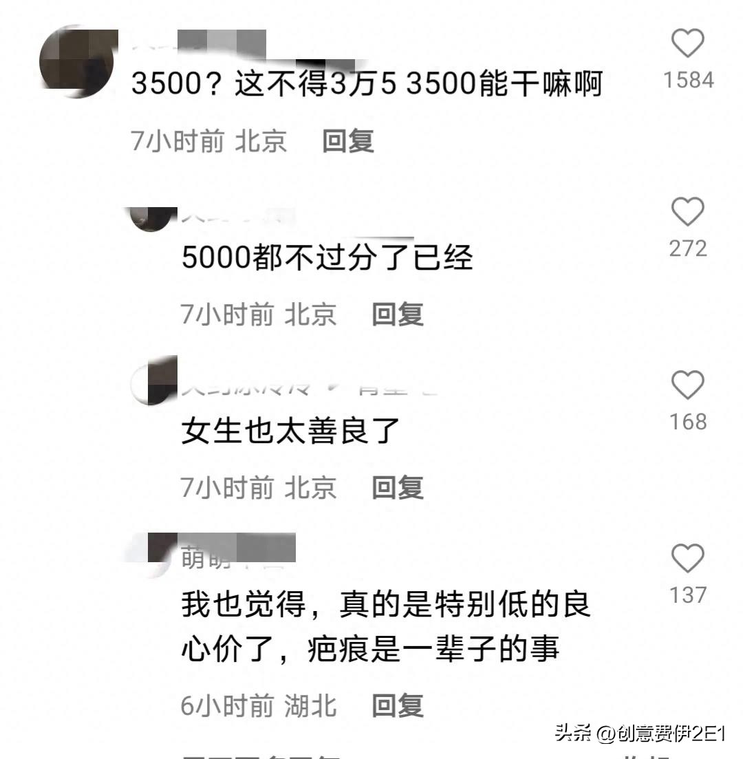 女生夜跑被恶犬咬伤后续,女子夜跑被恶犬咬伤在哪个部位