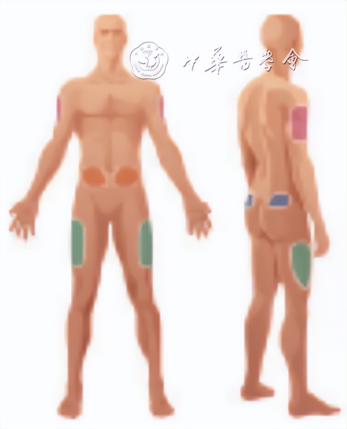 糖尿病病友自我管理手册,2022版ada糖尿病诊疗标准