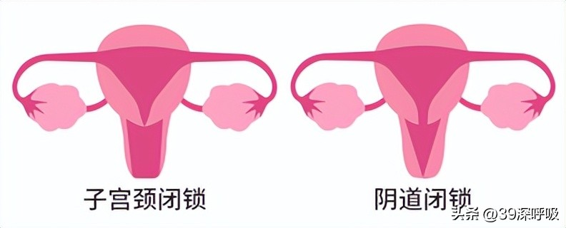 17岁女生从没来过月经，医生妙手为她重塑“女儿身”