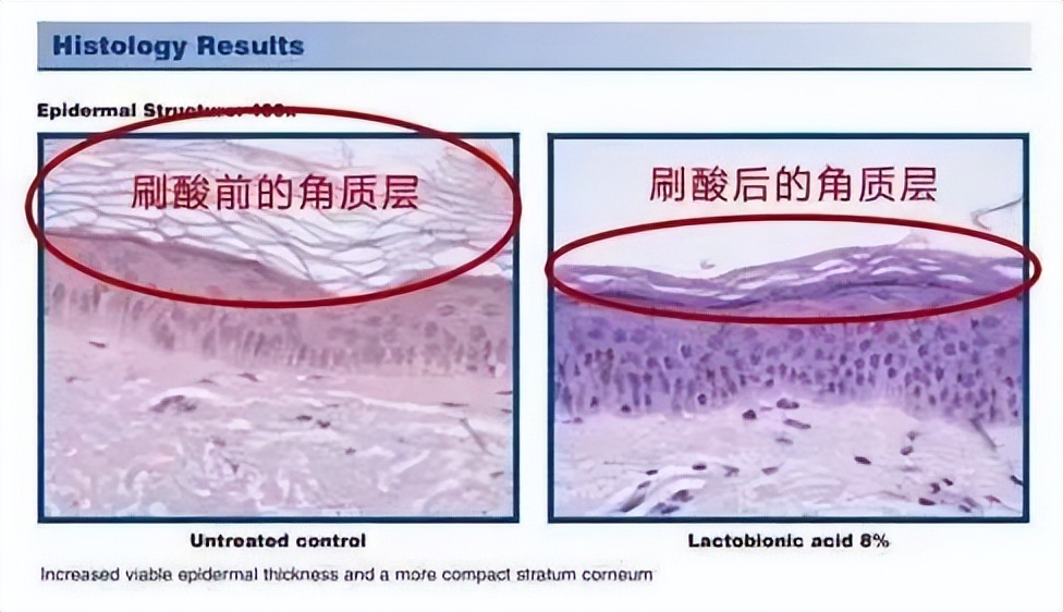 怎么护肤皮肤又细又滑又紧致,怎么护肤让皮肤更细滑一点